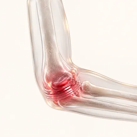 Post-Injury Stiffness