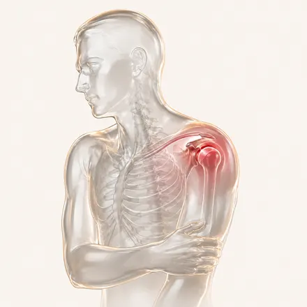 Shoulder Conditions