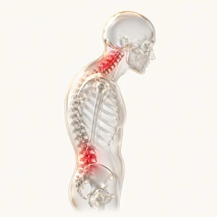 Postural & Movement-Related Pain